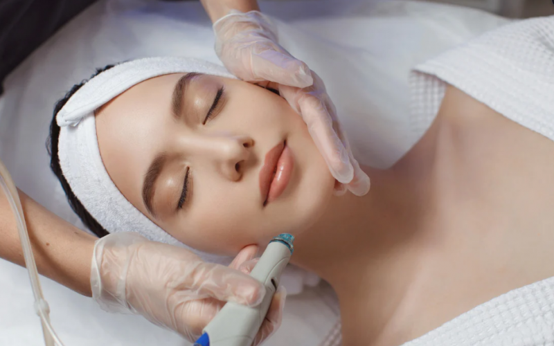 Geçmeyen Sivilcelerin Gizli Sebepleri ve Etkili Tedavisi